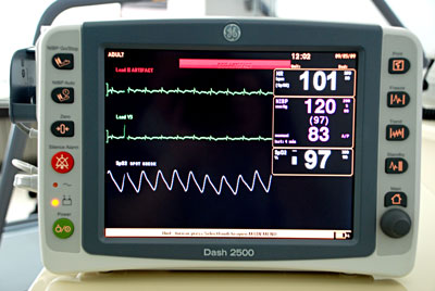 ge mars holter system